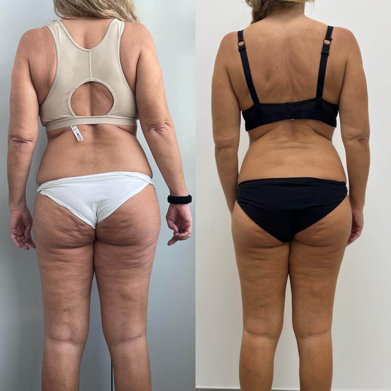 cs personal trainer rimini risultati prima e dopo -00002